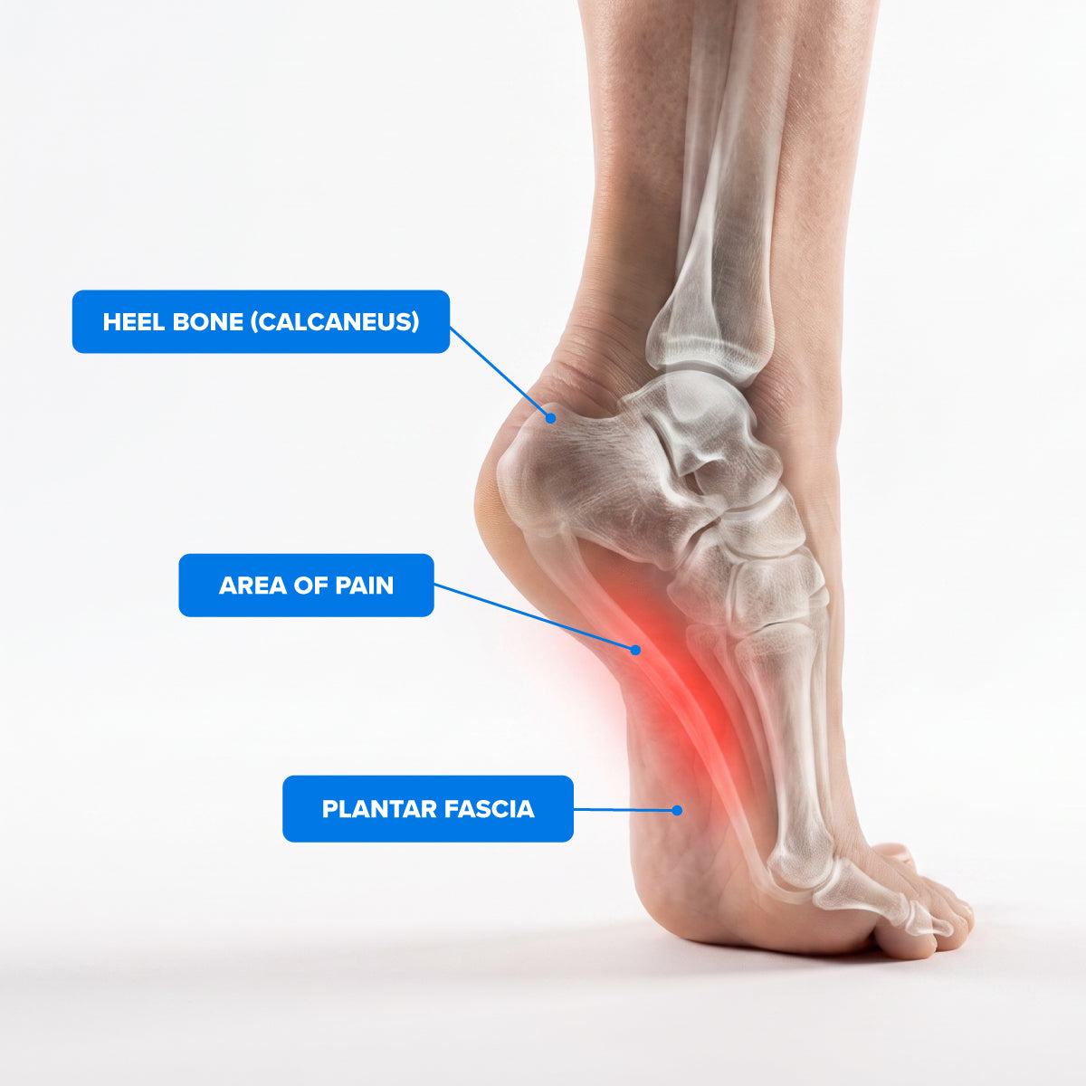 Compression Ankle Sleeve